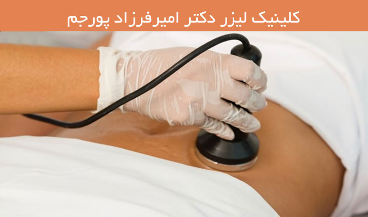 لاغری با دستگاه کویتیشن در رودهن